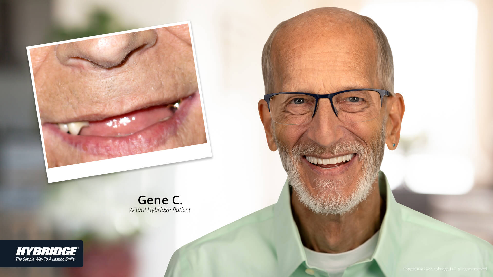 before-after_smile_gallery_w-bkgds_gene_1920x1080