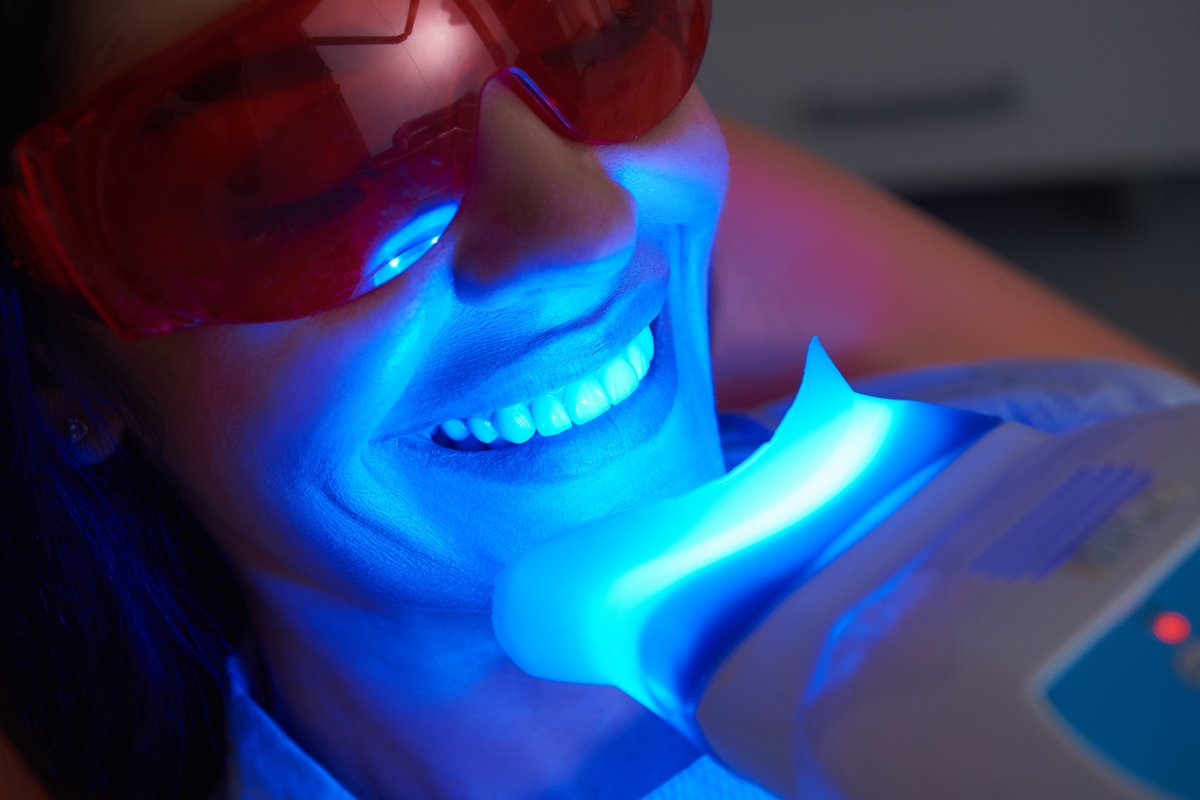 teeth whitening in Greenbrier