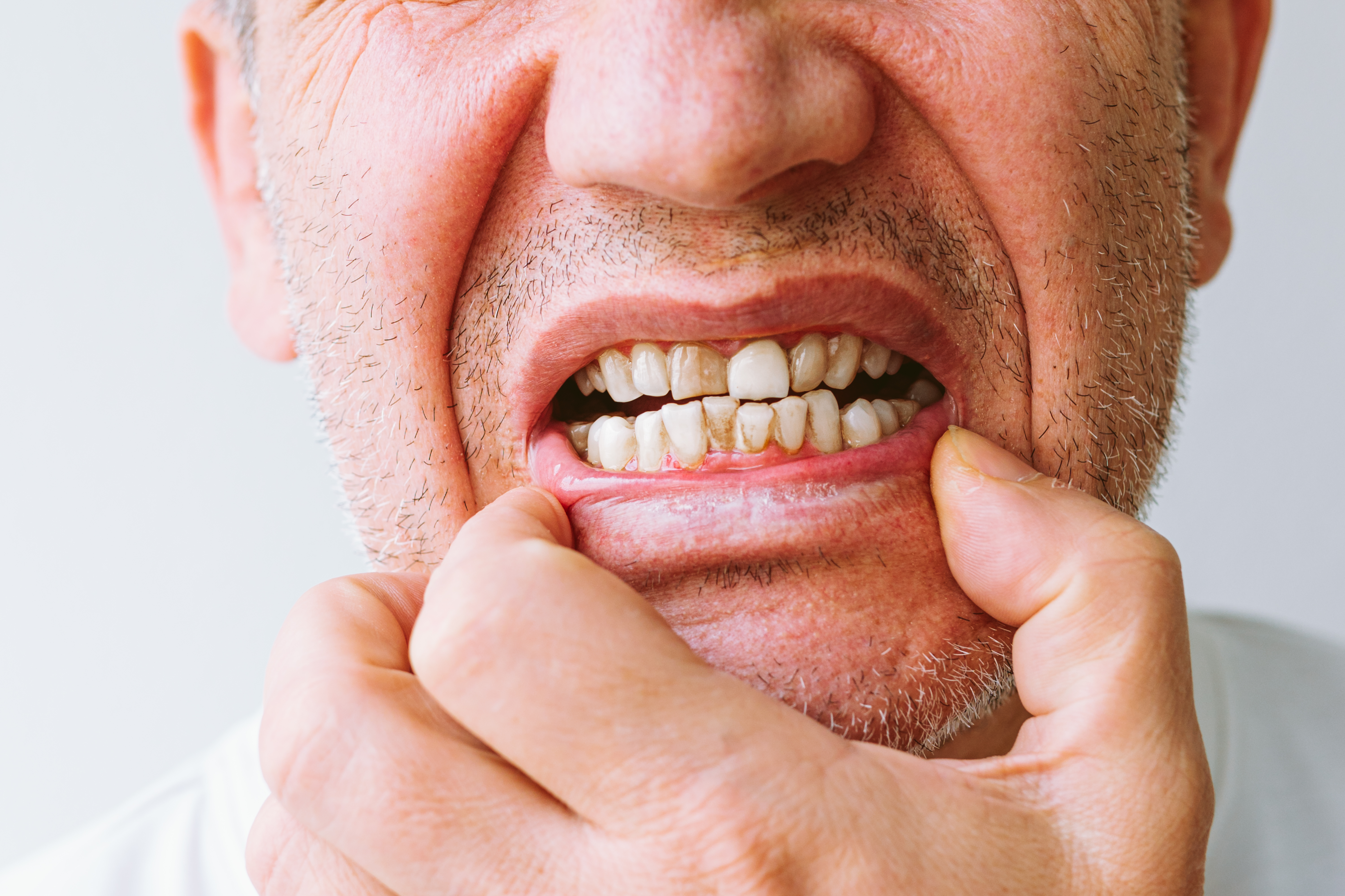 what are the risks of gum disease